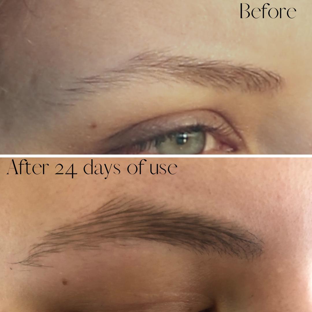 Brow Grow Advanced Conditioning Serum 2ml | Strengthen and Thicken Sparse Eyebrows-5